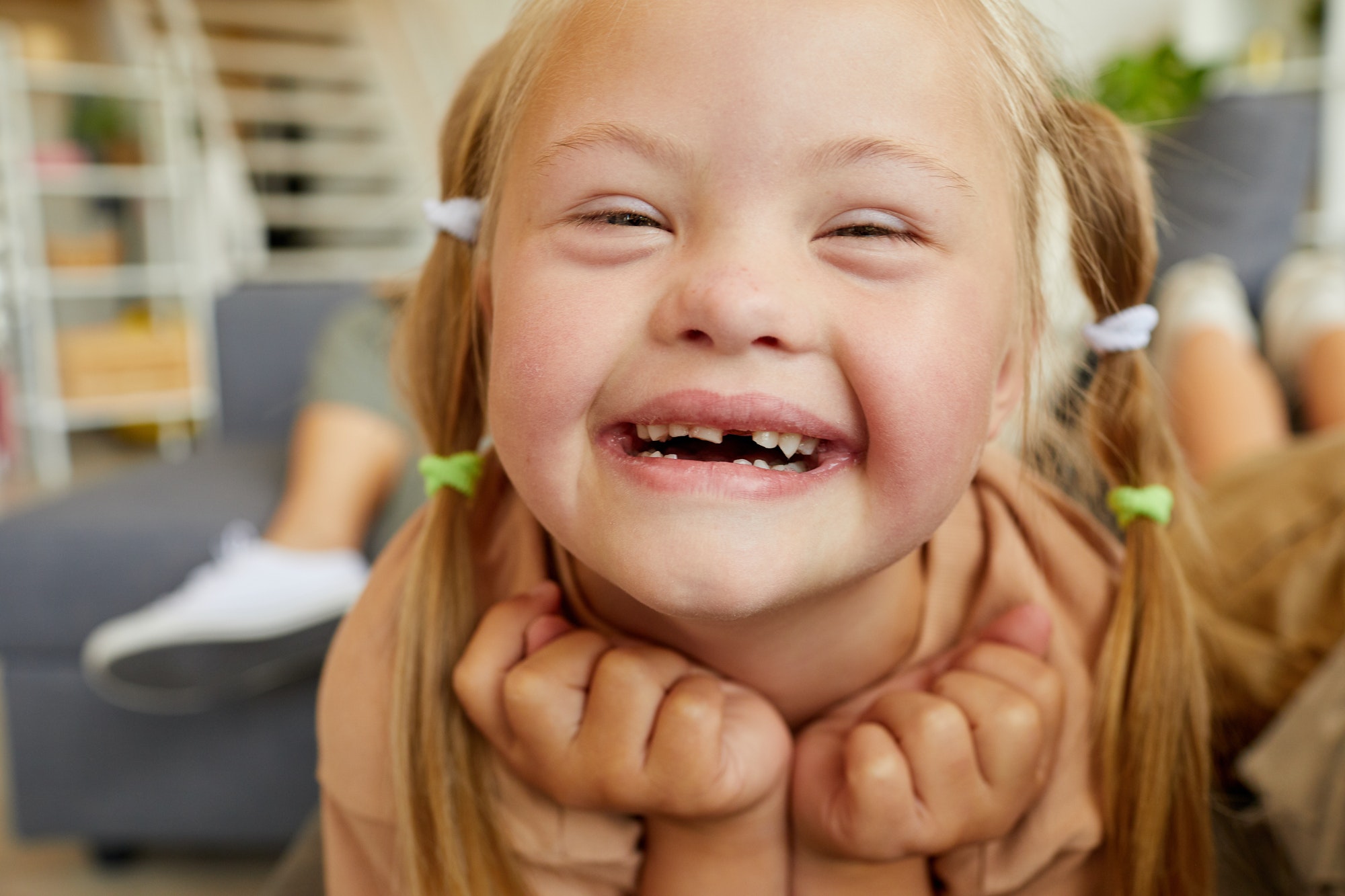 St. Louis Dentist For Children With Down Syndrome