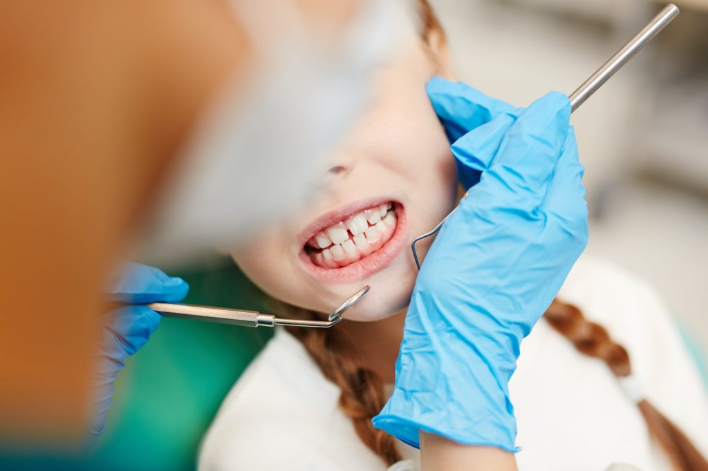 Pediatric dental sealants being applied to a child’s molars at Kids Smiles Pediatric Dentistry in St. Louis.