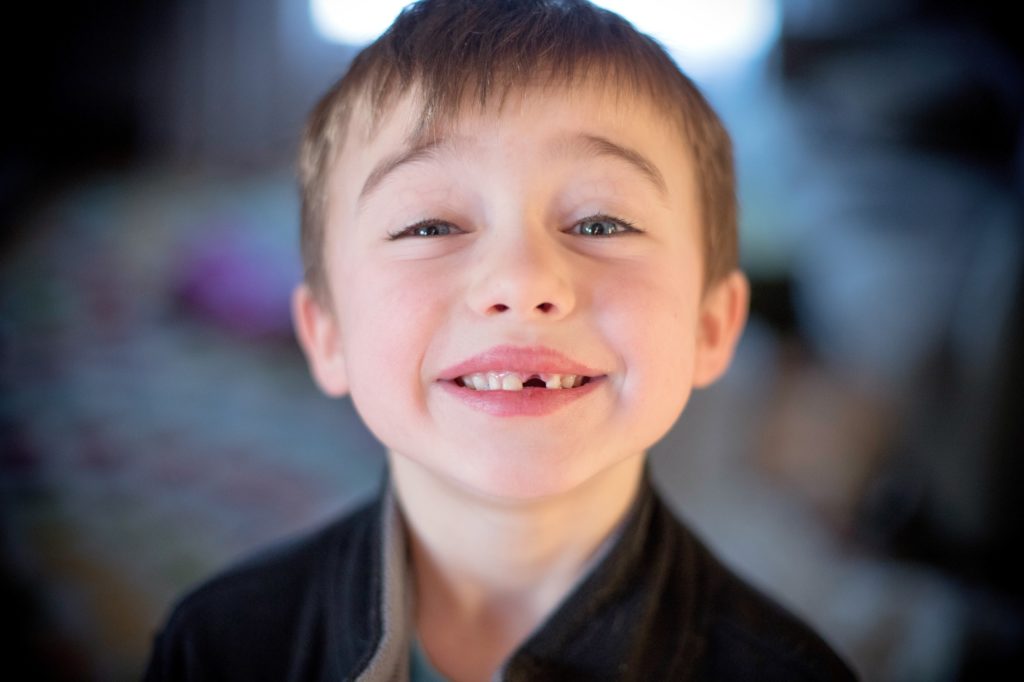 Young Boy Smiling with Missing Tooth