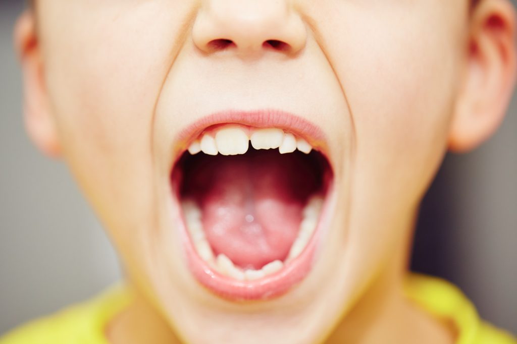 Pediatric dental exam identifying impacted teeth in a child at Kids Smiles Pediatric Dentistry, St. Louis.