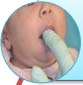 Post-operative lip mobility exercise for infant at Kids Smiles Pediatric Dentistry