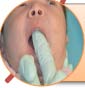 Newborn oral stretching technique post-frenectomy by Dr. Kelly Jobe in St. Louis